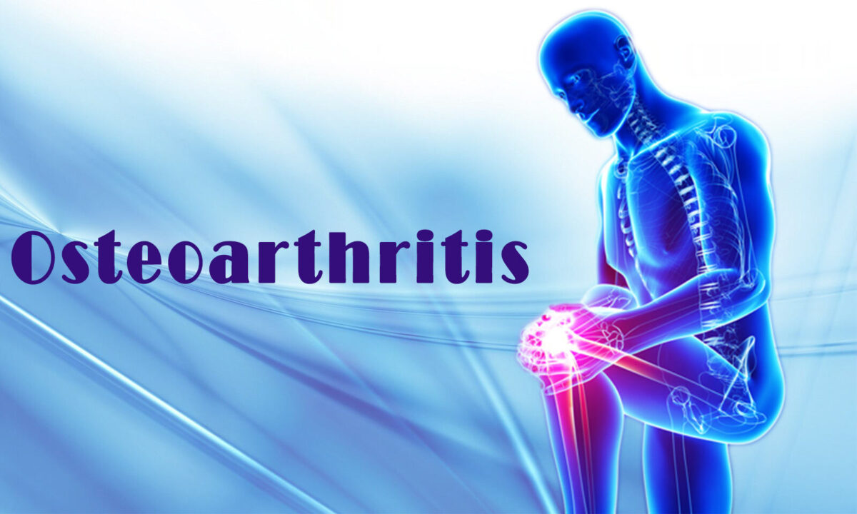 Osteoarthritis in the News